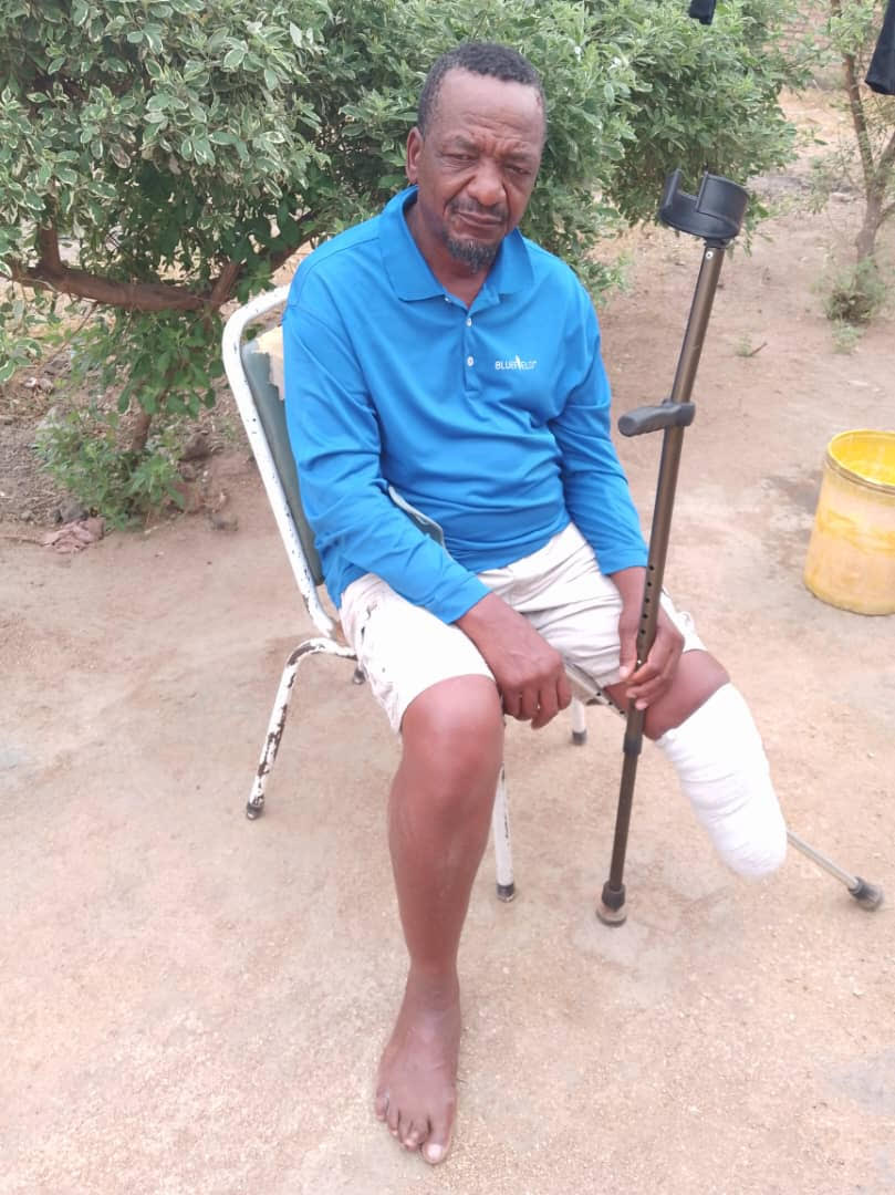 Crocodile Victim Gets Support For Artificial Leg